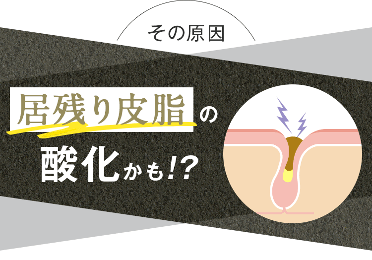 その原因、居残り皮脂の酸化かも？