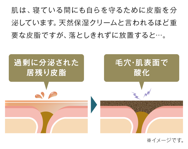 過剰に分泌された居残り皮脂が毛穴・肌表面で酸化